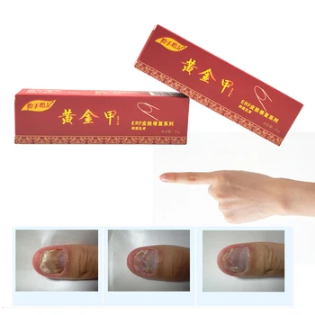 2 ks Čínskej Medicíny Omietky Nechtov Liečba Krém Onychomycosis Proti Plesňové Infekcie Nechtov Bojuje Baktérie Prirodzene masť