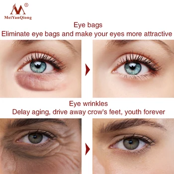 MeiYanQiong Očné Sérum Odstránenie Vrások Anti-Opuchy Anti-Aging Tmavé Kruhy Pod Očami Vrecia Zdvíhacie Spevňujúci Očný Podstate Krém Pre Starostlivosť O Pleť