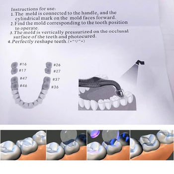 Zubné Zadné zuby estetické tlač plesne