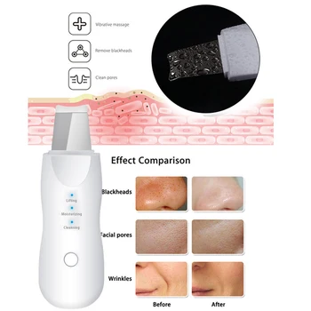 Nabíjateľná Ultrazvukové Kože Tváre Práčky Tváre Čistiaci Peeling Vibrácií Blackhead Odstránenie Exfoliačný Pórov Cleaner Nástroje