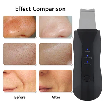 Nabíjateľná Ultrazvukové Kože Tváre Práčky Tváre Čistiaci Peeling Vibrácií Blackhead Odstránenie Exfoliačný Pórov Cleaner Nástroje