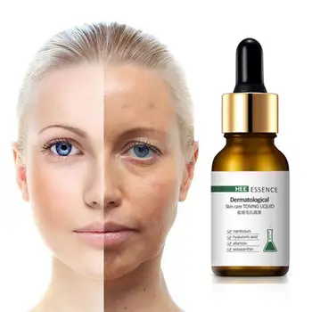 Proti Starnutiu Kože Tváre Starostlivosť 30ml Kyselina Hyaluronová Vitamín C Podstate Retinol Bieliace Sérum Hydratačný
