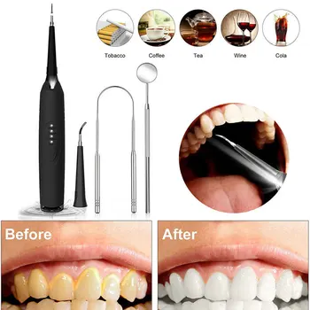 Zubár Ústne Hygience Elektrické Ultrazvukové Sonic Scaler Zubnému Kameňu Odstraňovač Cleaner Bielenie Zubov Škvrny Zubného Kameňa Nástroj