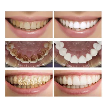 LANBENA Bielenie Zubov Podstate Kvapaliny Ústnu Hygienu Zubov Bielenie, Leštenie Nástrojov Odstraňuje Zubný Plak a Škvrny Bielenie Zubov