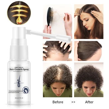 Proti Vypadávaniu Vlasov Rast Vlasov Sprej Esenciálny Olej, Kvapalina Starostlivosť O Vlasy Poškodené Vlasy Repair Treatment Muži Ženy Suché Vlasy Starostlivosť Produkt