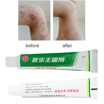 5 Ks Masť, z psoriáza yiganerjing krém ekzém dermatitídy erytromycín masť úľavu bolestivé svaly krém