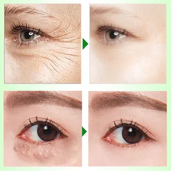 Kyselina Hyaluronová Anti-Wrinkle Eye Cream Fade Temný Kruh Anti-Aging Proti Opuchy Gél Odstrániť Oko Taška Hydratačná Starostlivosť O Pleť