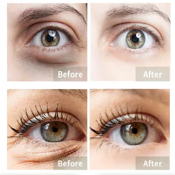 Kyselina Hyaluronová Anti-Wrinkle Eye Cream Fade Temný Kruh Anti-Aging Proti Opuchy Gél Odstrániť Oko Taška Hydratačná Starostlivosť O Pleť