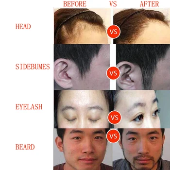 FUE vlasový Folikul Extractor Scarless Bezsrstý Liečba Implantované Vlasy Výsadbu Chĺpkov Obočia, make-up Nástroje/Doplnky Tweezer