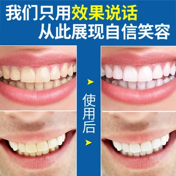 Biele Zuby Bieliace Prúžky gél zuby, starostlivosť o ústnu dutinu Essentials Ústna Hygiena, Starostlivosť o zub Úsmev Čistý zub Bieliace Zubné Nástroje