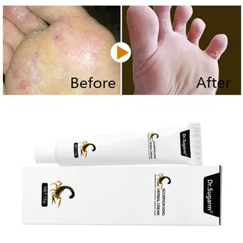 Dr. Sugarm Bylinné Účinné Nohy Ošetrenie Proti Hubovým Dermatitídy Eczematoid Ekzém Psoriáza Telový Krém Pre Starostlivosť O Pleť Krém